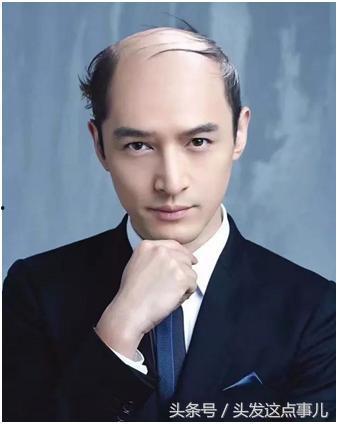 有哪些明星秃顶了,盘点那些头顶“新潮流”的明星